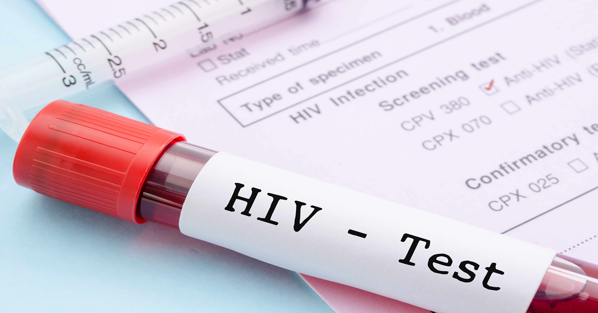 NHS HIV testing rollout identifies hundreds of new cases